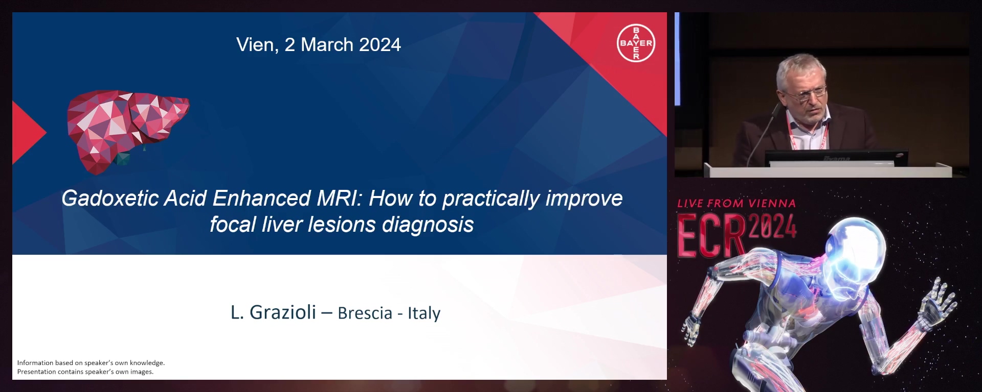 Gadoxetic acid-enhanced MRI: : how to practically improve focal liver lesions diagnosis