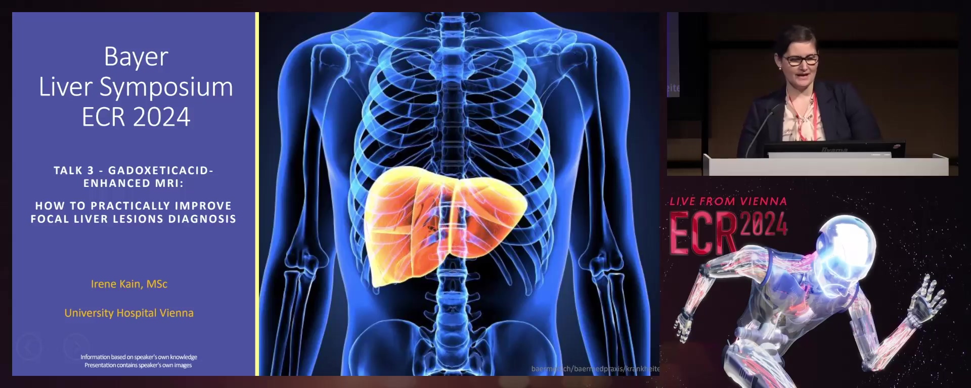 Gadoxetic acid-enhanced MRI: : how to practically improve focal liver lesions diagnosis