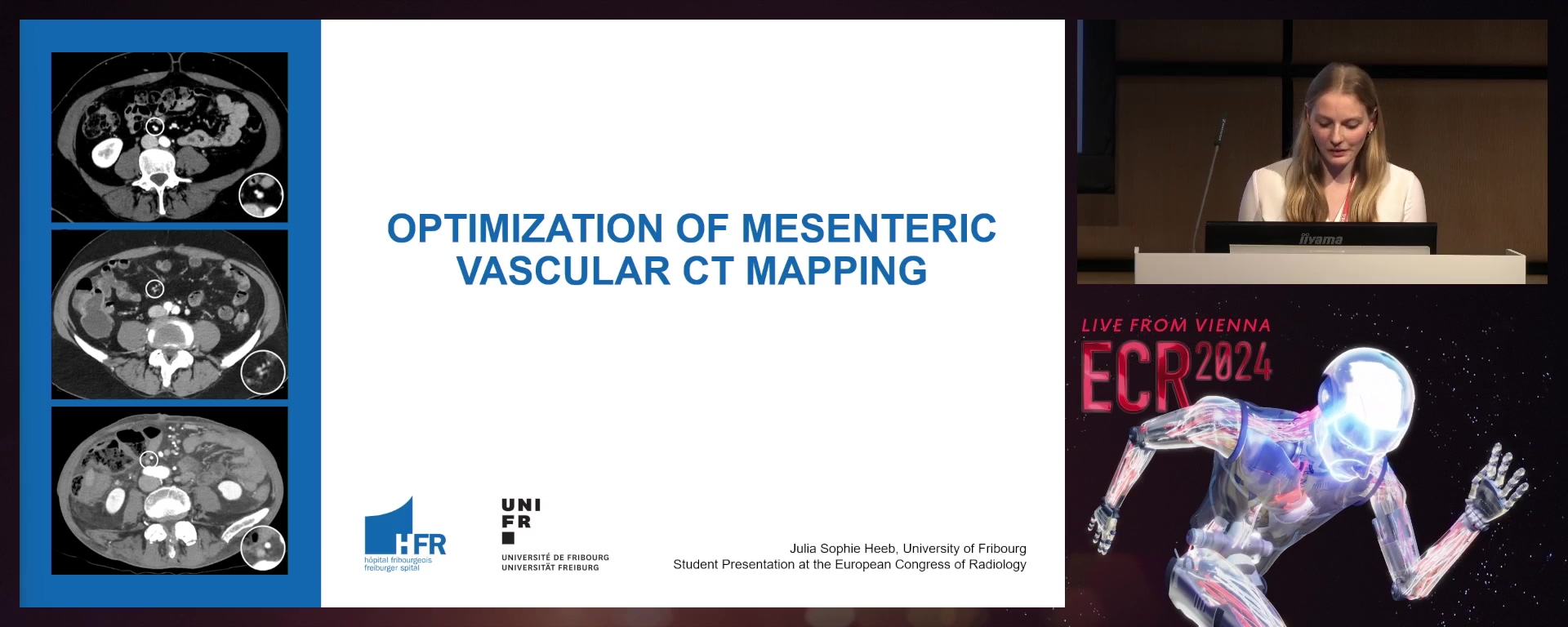 Optimisation of mesenteric vascular CT mapping