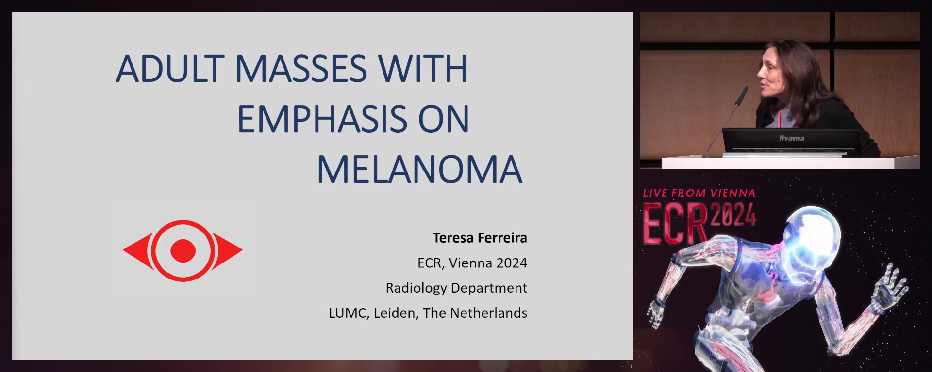 Adult masses with emphasis on melanoma