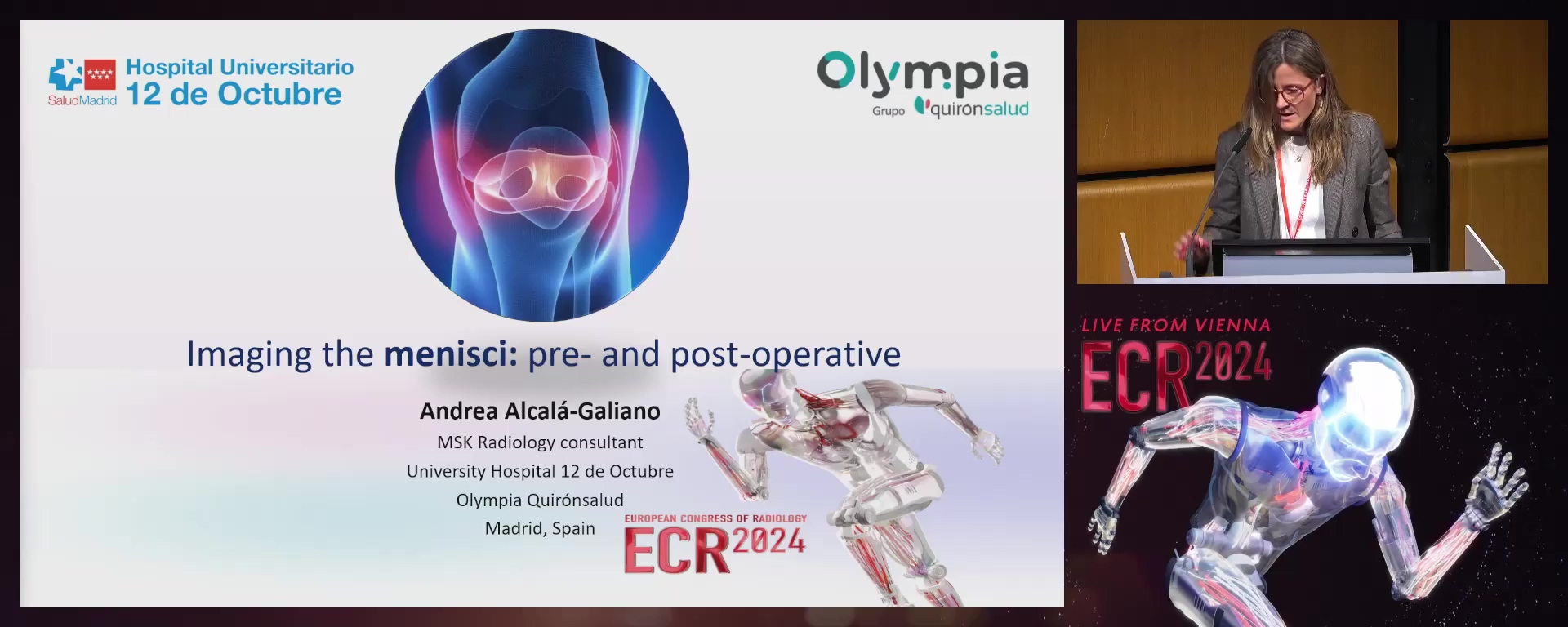 Imaging the menisci pre- and post-operative