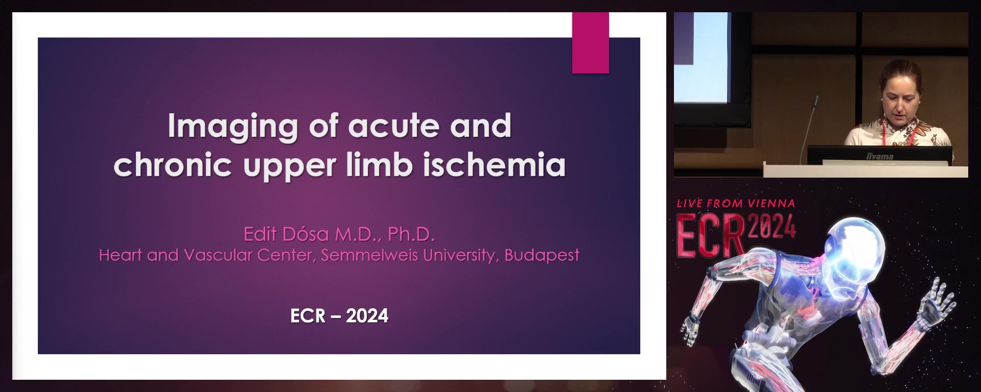 Imaging of acute and chronic upper limb ischaemia