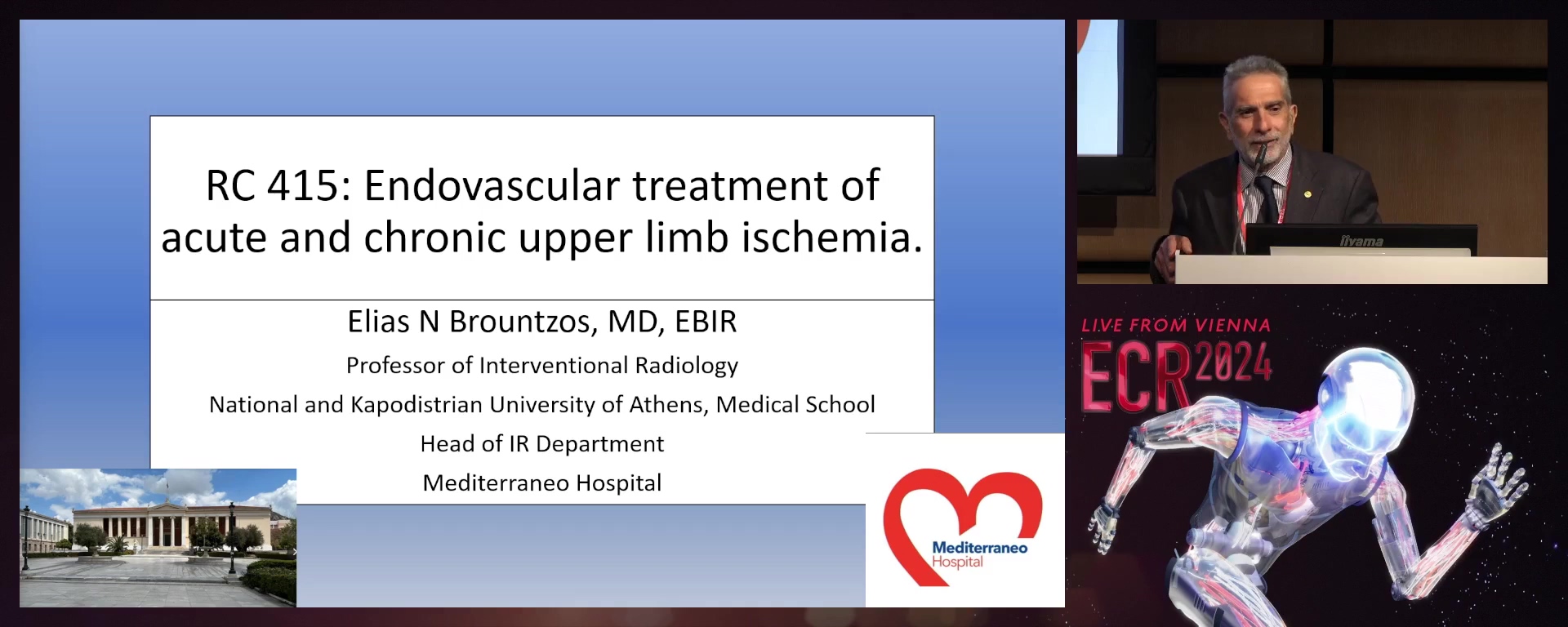 Endovascular treatment of acute and chronic upper limb ischaemia