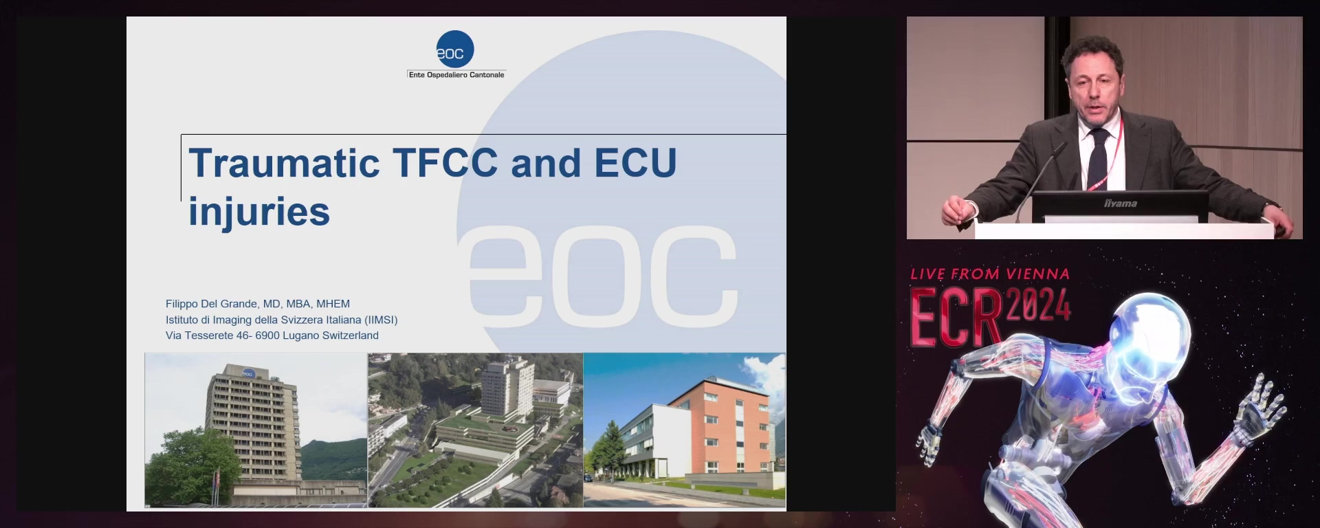 Traumatic TFCC and ECU injuries