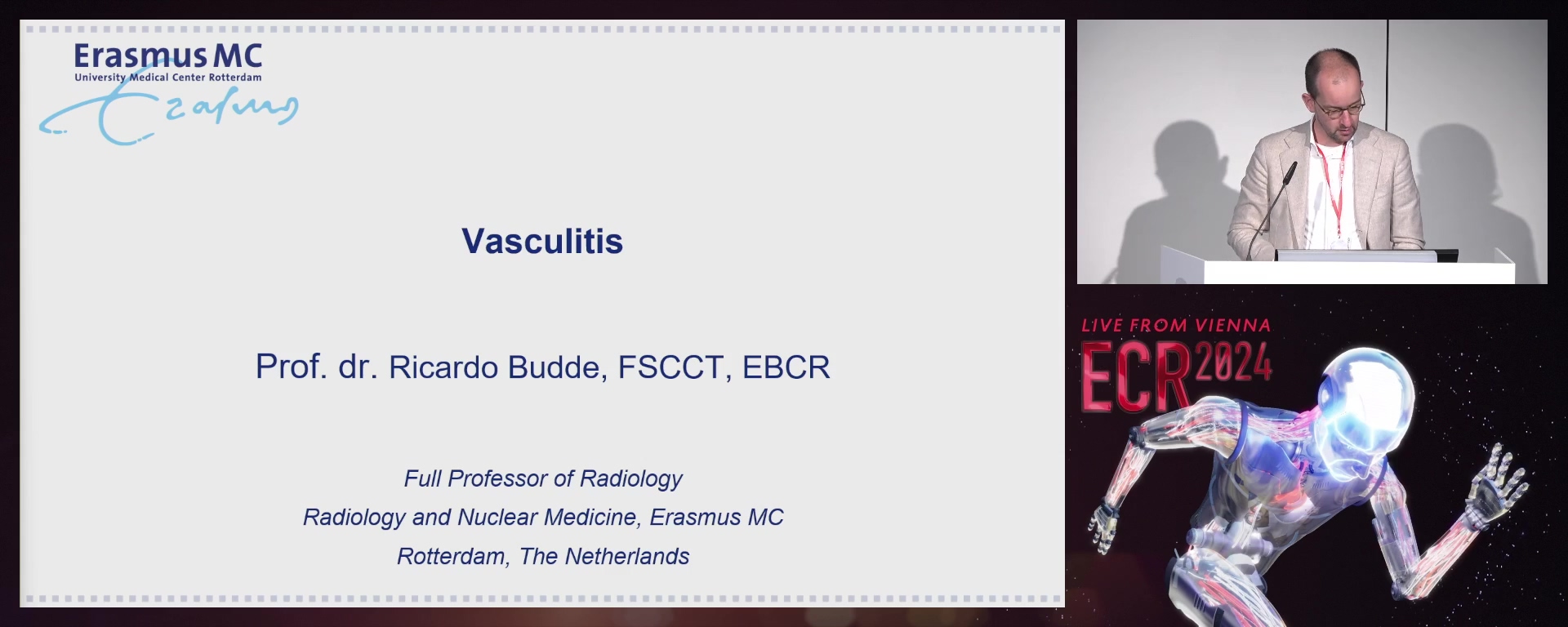 Vasculitis