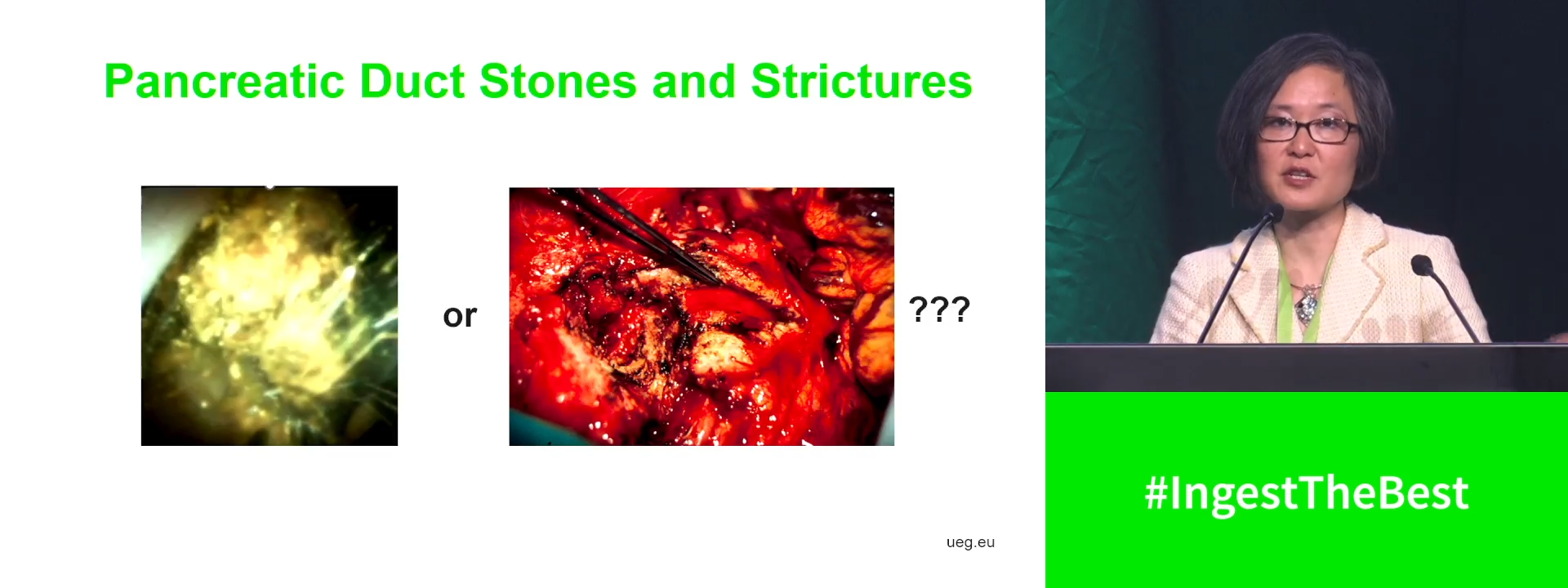 Summary: Management of pancreatic diseases - Knife or scope?