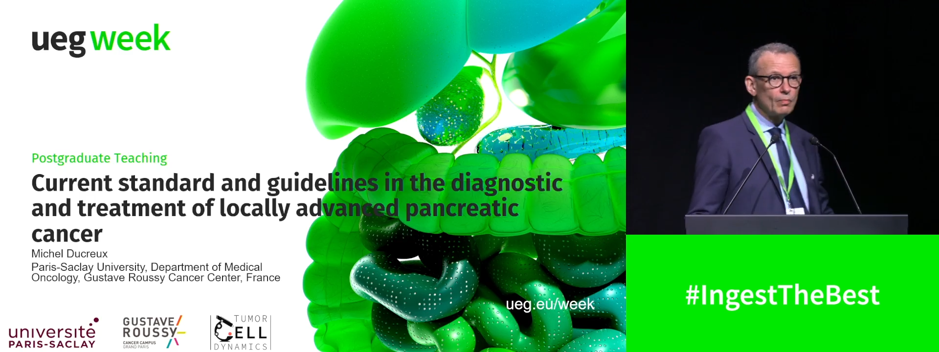 Current standard and guidelines in the diagnostic and treatment of locally advanced pancreatic cancer