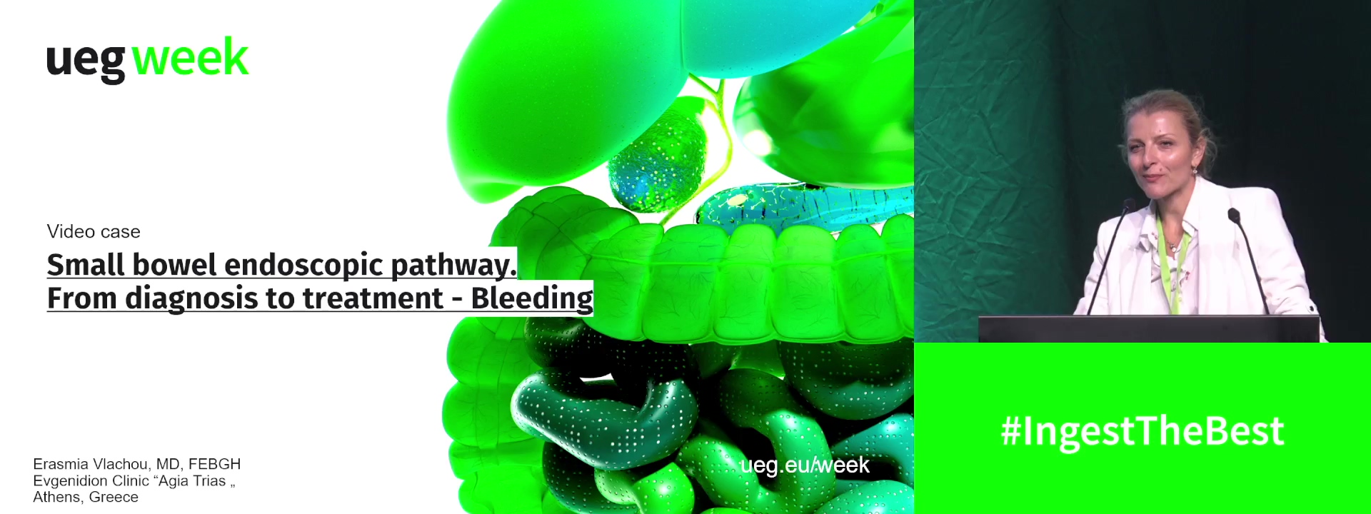 Video Case: Small bowel endoscopic pathway. From diagnosis to treatment - Bleeding