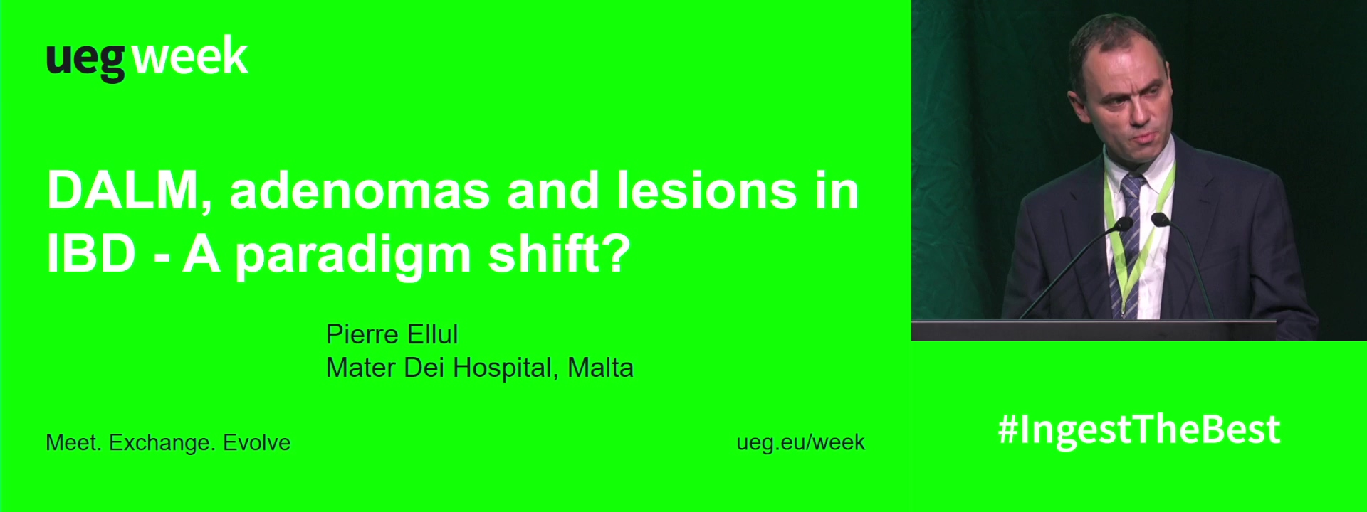 Video Case: DALM, adenomas and lesions in IBD - A paradigm shift?