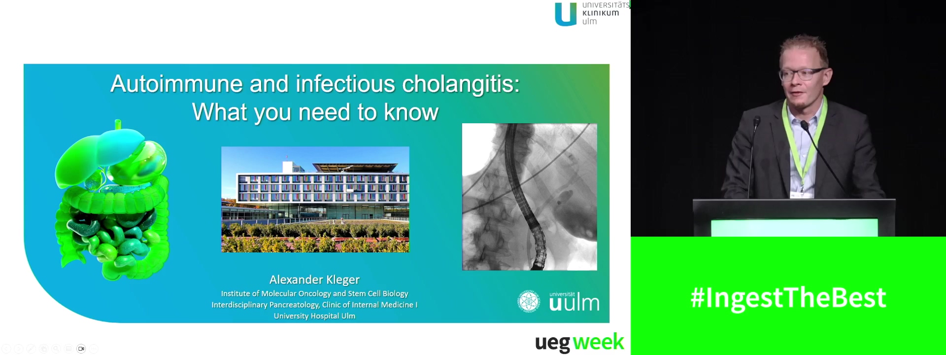 Autoimmune and infectious cholangitis: What you need to know