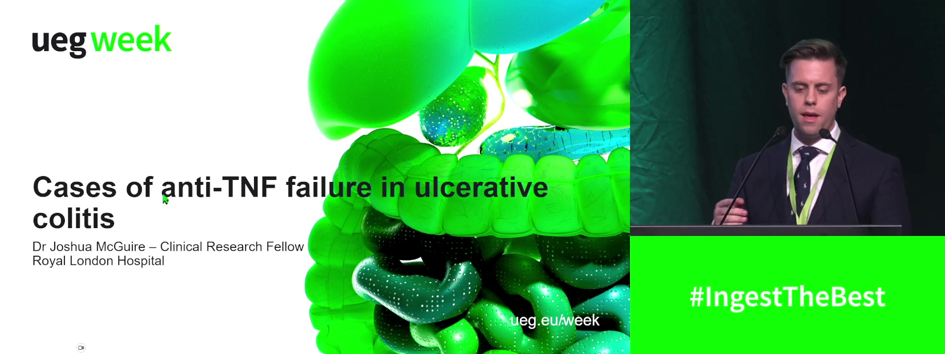 Anti-TNF failure in Crohn's disease
