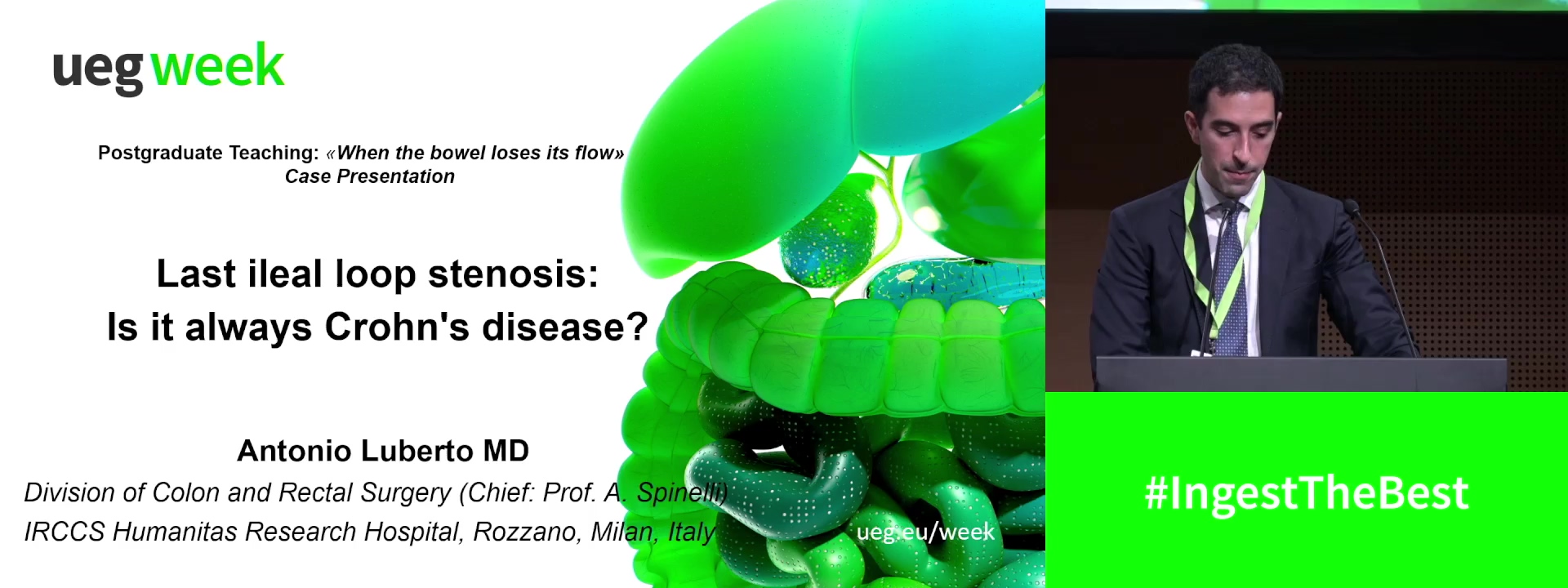 Last ileal loop stenosis: Is it always Crohn's disease?