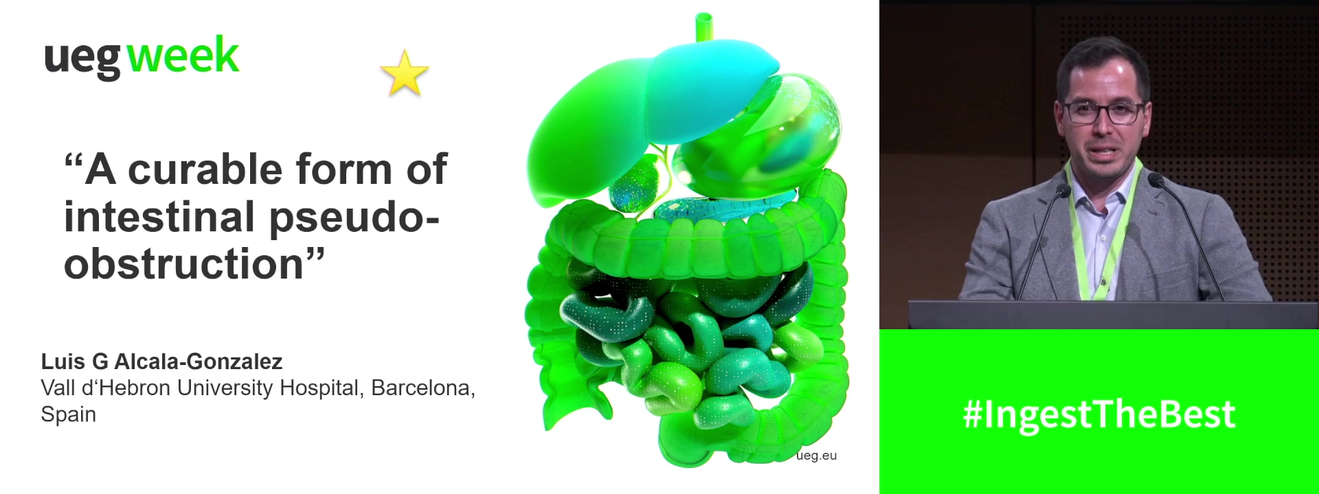 A curable form of intestinal pseudo-obstruction