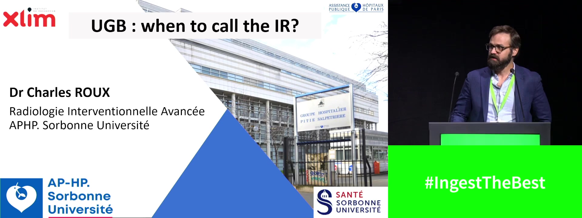 When to call the interventional radiologist for UGIB: Embolisation and TIPS