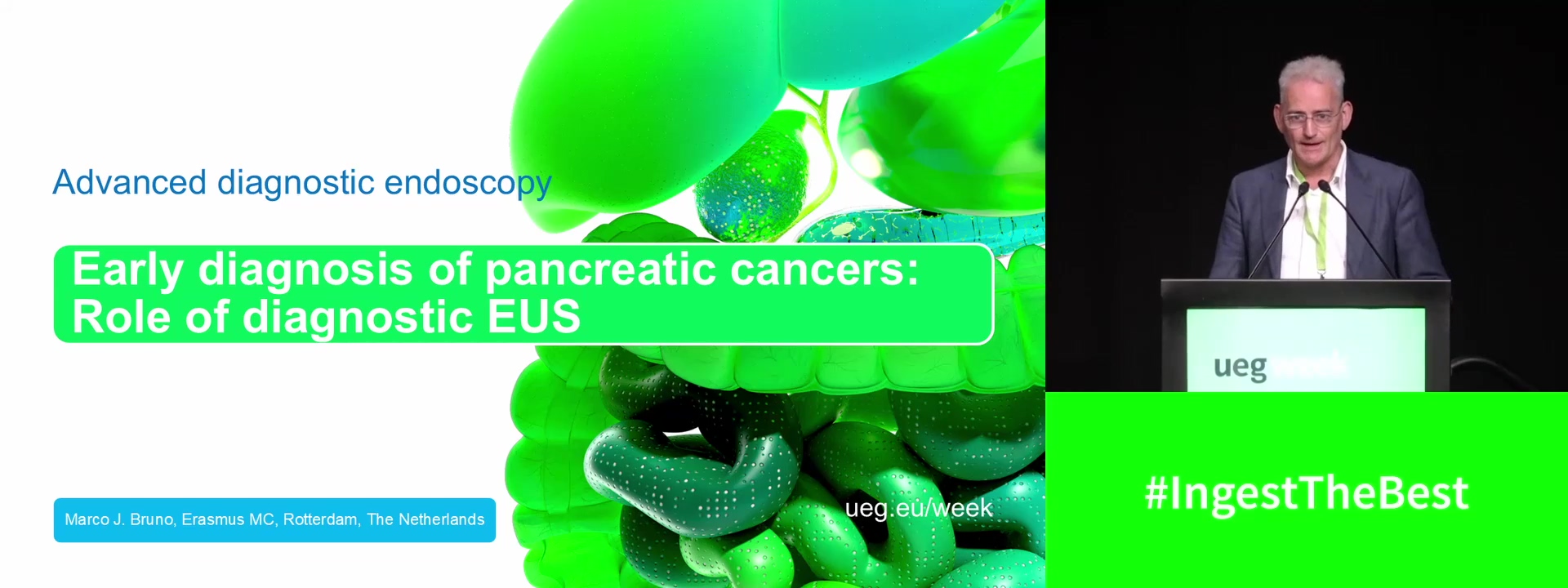 Early diagnosis of pancreatic cancers: Role of diagnostic EUS