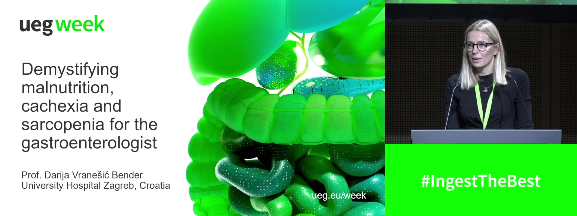 Demystifying malnutrition, cachexia and sarcopenia for the gastroenterologist