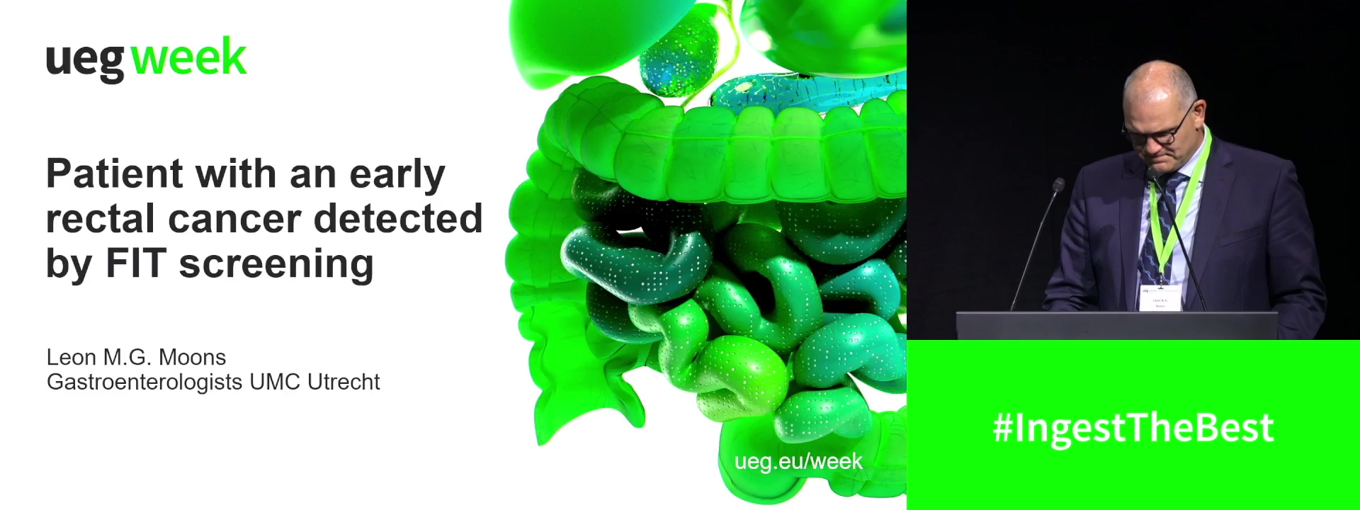 Patient with an early rectal cancer detected by FIT-screening