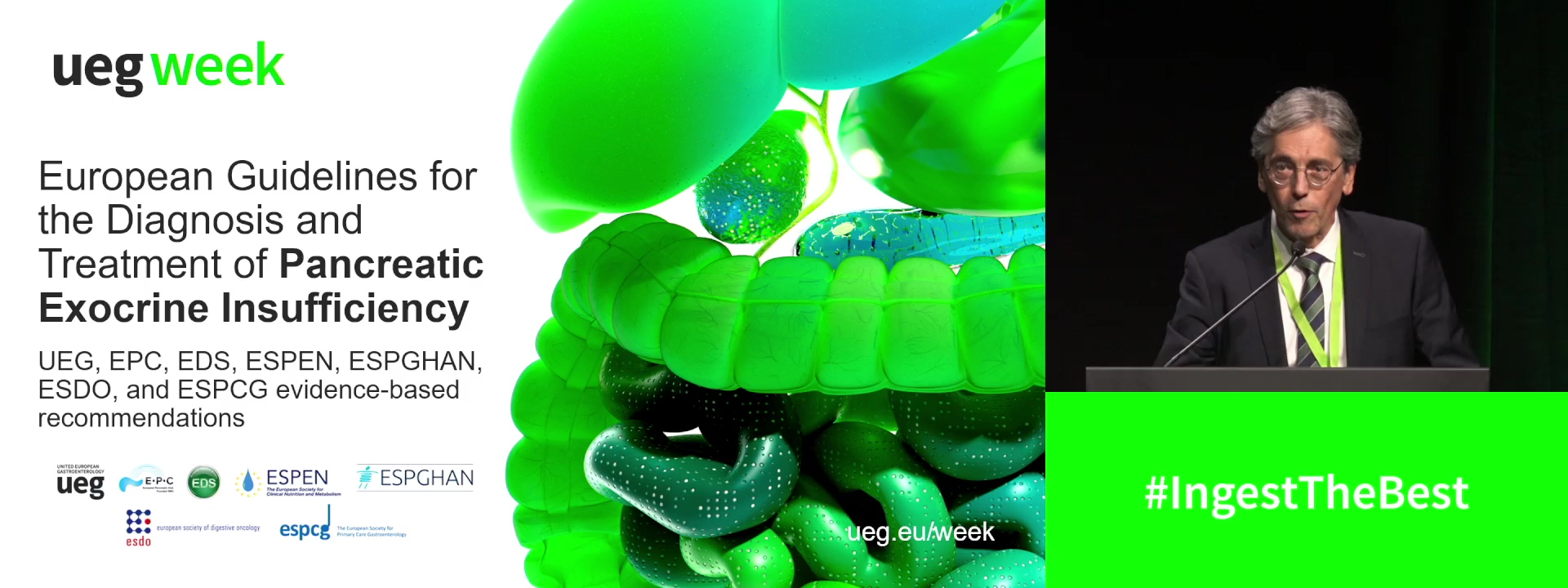 European guideline on the diagnosis and therapy of pancreatic exocrine insufficiency