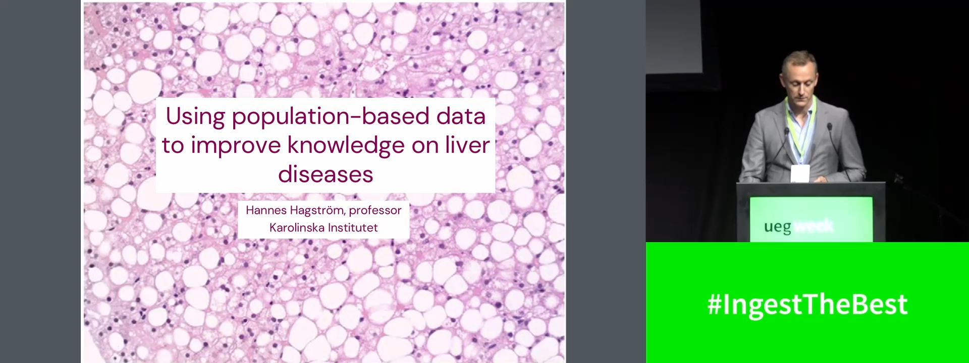 Using population-based data sources to improve knowledge on liver diseases