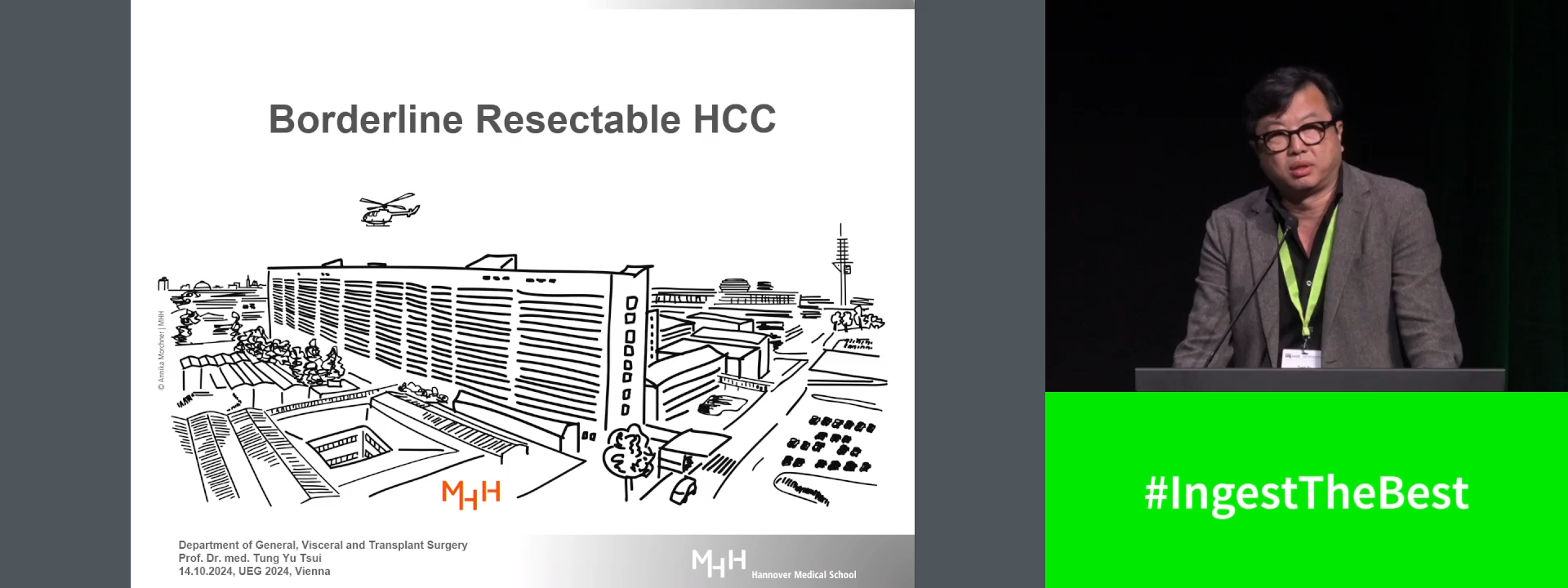 Borderline resectable hepatocellular carcinoma