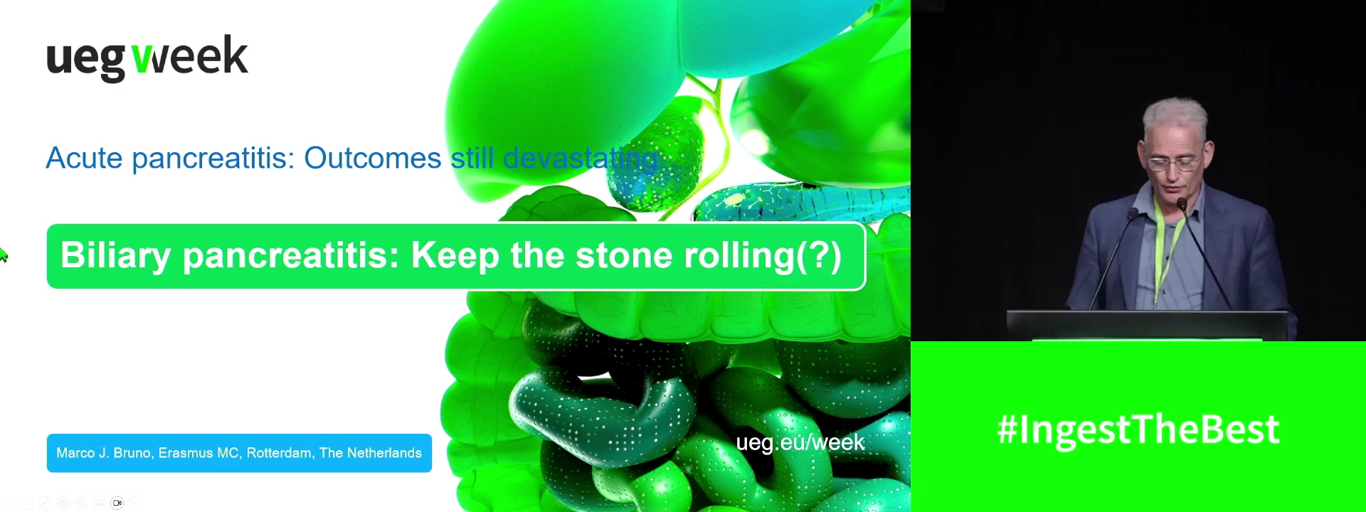 Biliary pancreatitis: Keep the stone rolling