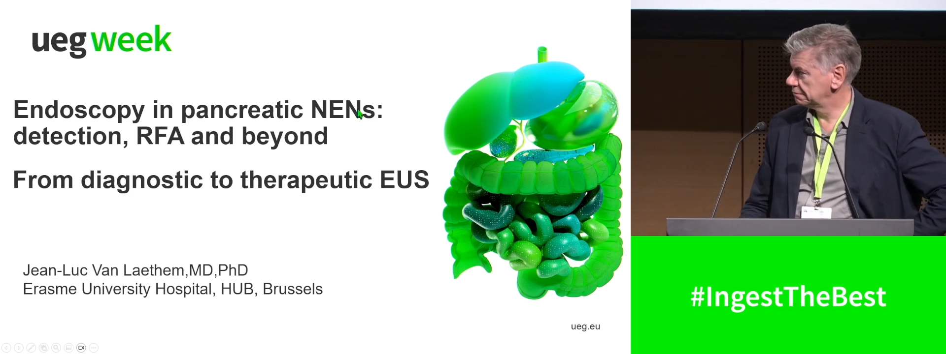 Endoscopy in pancreatic NENs: Detection, RFA and beyond