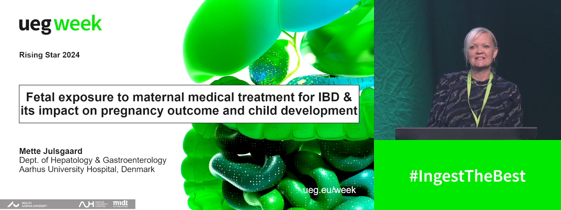 Fetal exposure to maternal medical treatment for IBD and its impact on pregnancy outcome and child development
