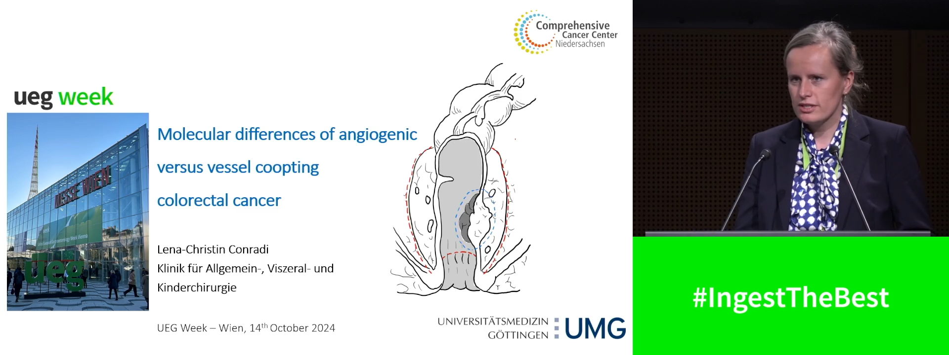 Molecular differences of angiogenic versus vessel co-opting colorectal cancer