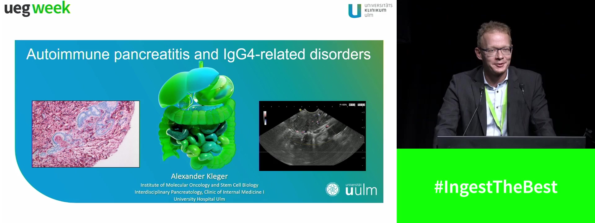 Autoimmune pancreatitis and IgG4-related disorders