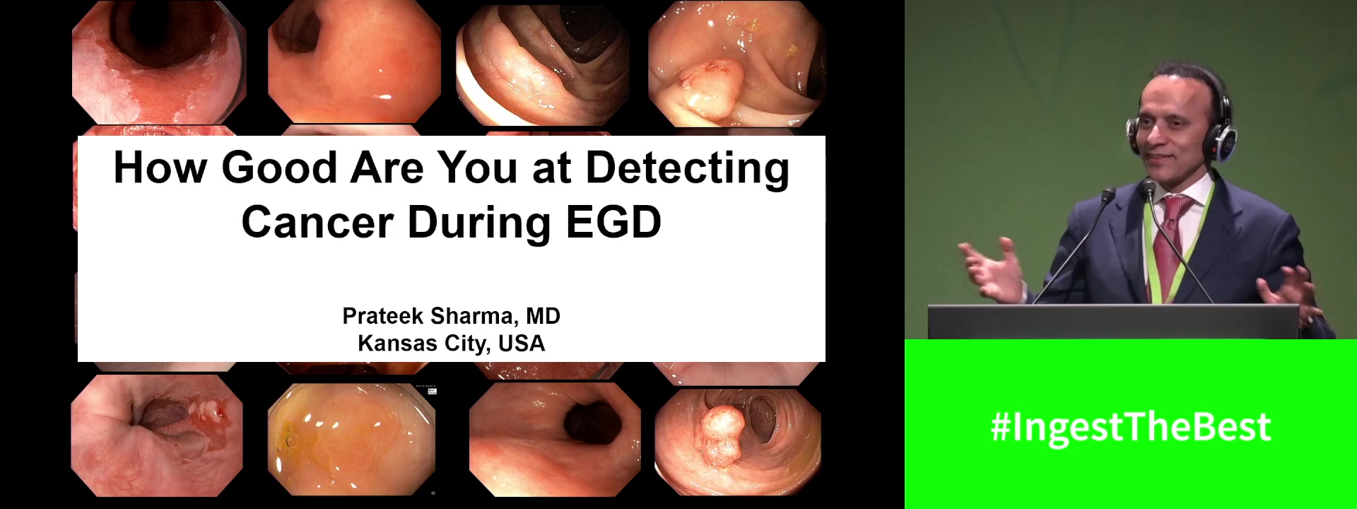 Endoscopy: How good are you at detecting cancer?