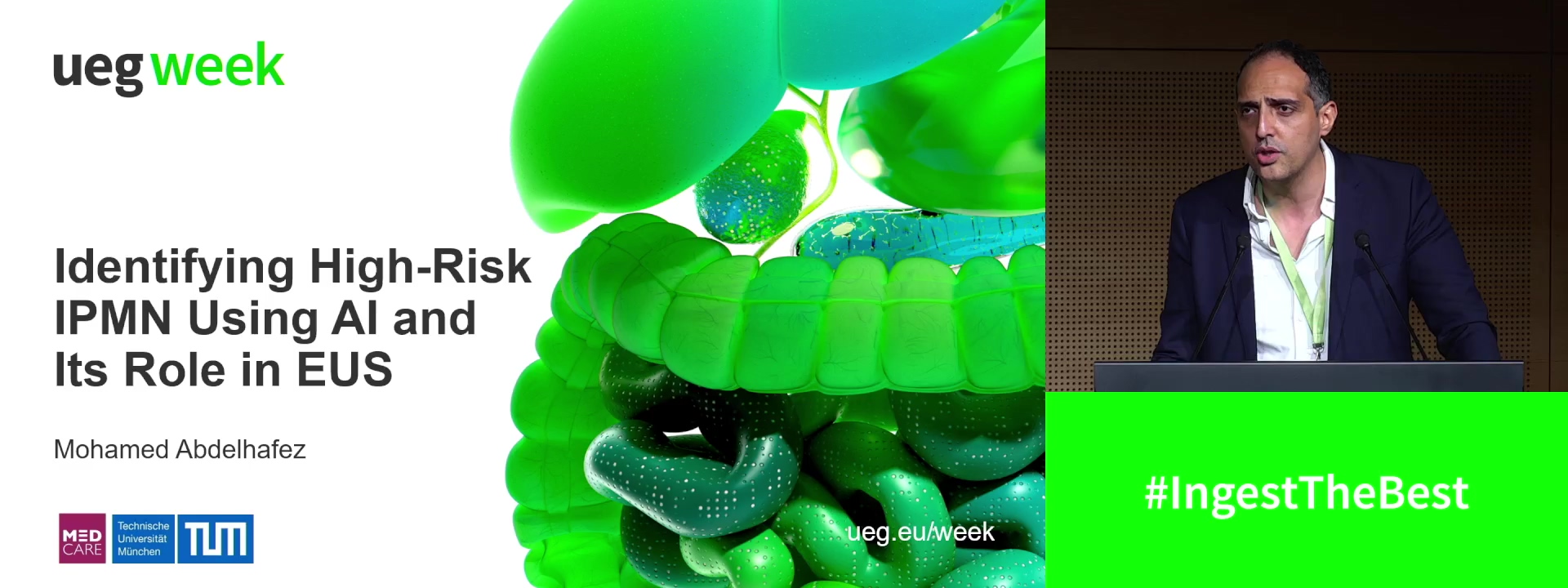 Identifying high-risk IPMN using AI and its role in EUS