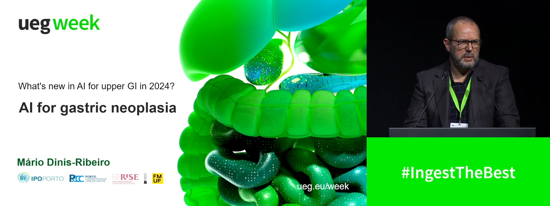 Artificial intelligence for gastric neoplasia