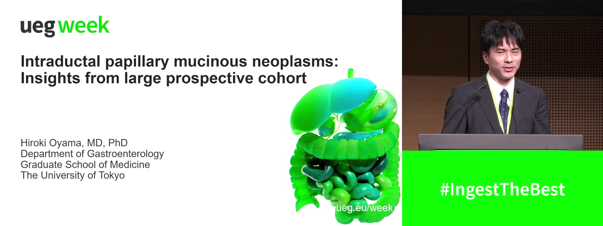 Intraductal papillary mucinous neoplasms: Insights from large prospective cohort