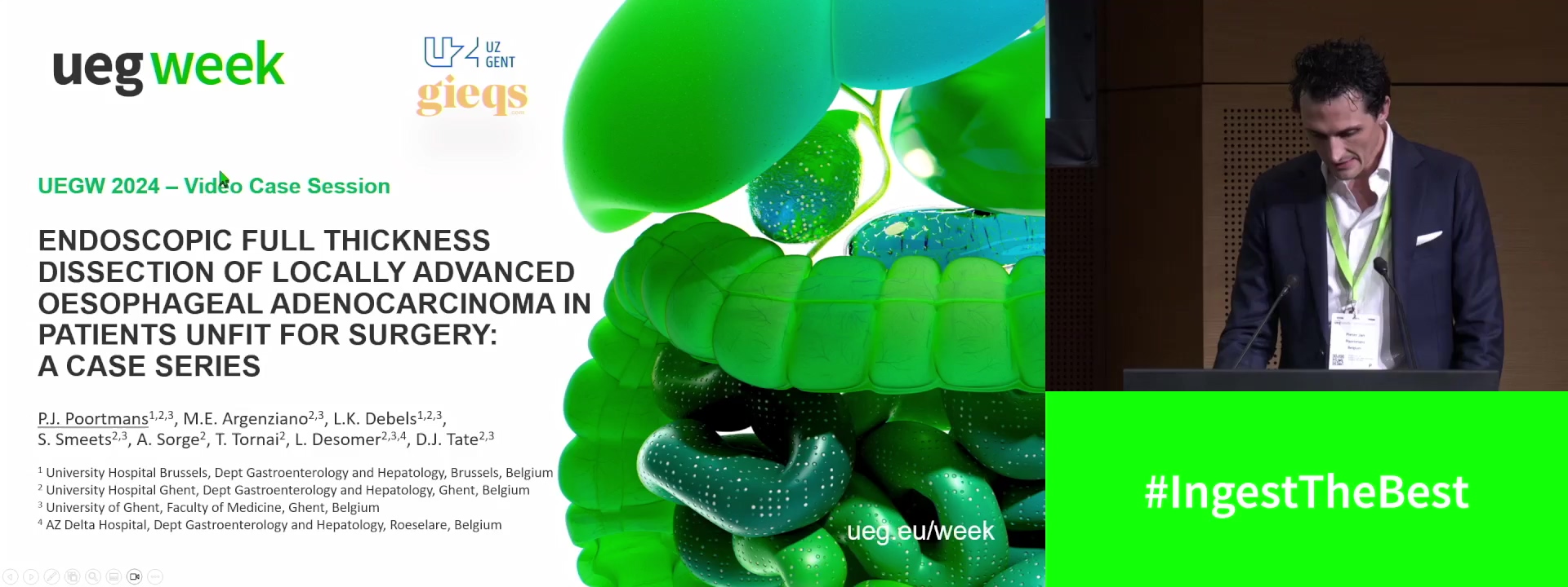 ENDOSCOPIC FULL THICKNESS DISSECTION OF LOCALLY ADVANCED OESOPHAGEAL ADENOCARCINOMA IN PATIENTS UNFIT FOR SURGERY: A CASE SERIES (WITH VIDEO)