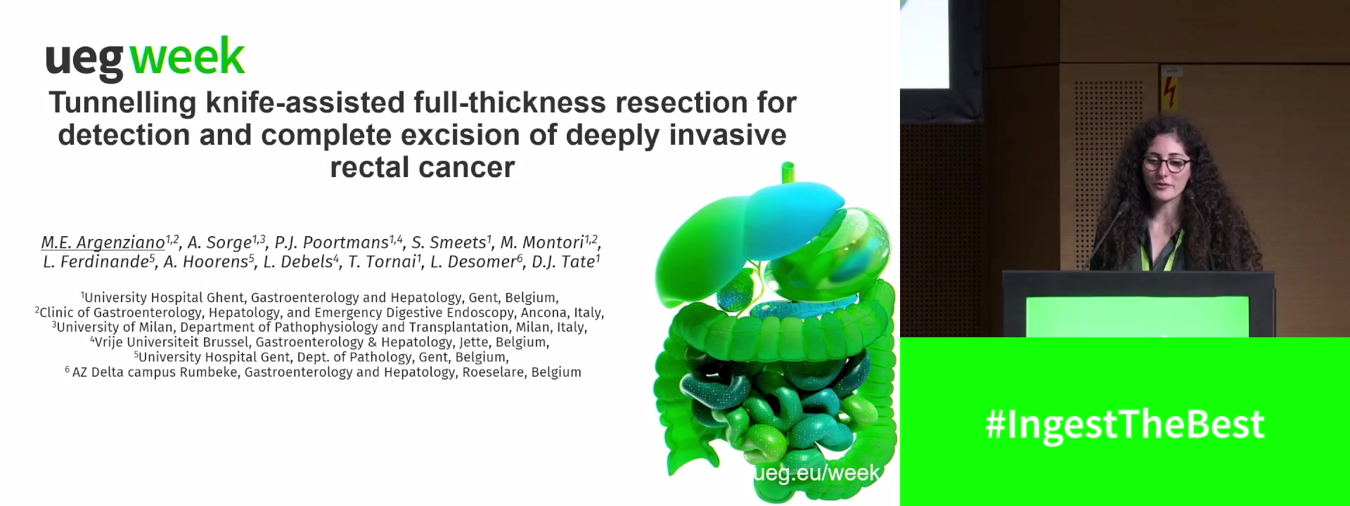 ENDOSCOPIC KNIFE-ASSISTED FULL-THICKNESS RESECTION OF A DEEPLY INVASIVE RECTAL CANCER USING A COMBINATION OF POCKET-CREATION AND SALINE-IMMERSION TECHNIQUES