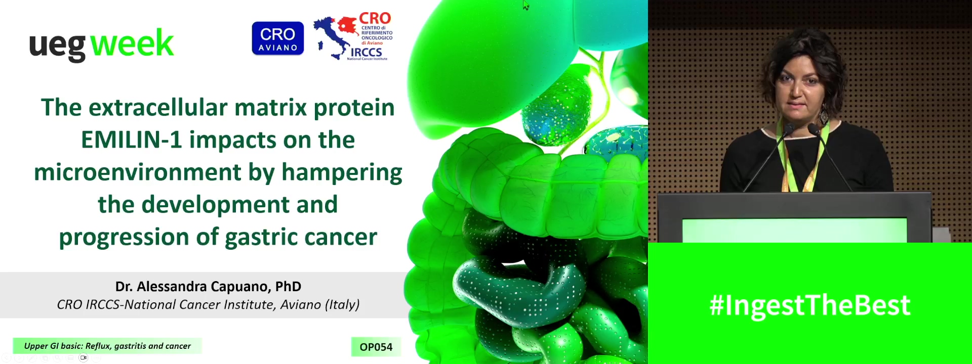THE EXTRACELLULAR MATRIX PROTEIN EMILIN-1 IMPACTS ON THE MICROENVIRONMENT BY HAMPERING THE DEVELOPMENT AND PROGRESSION OF GASTRIC CANCER