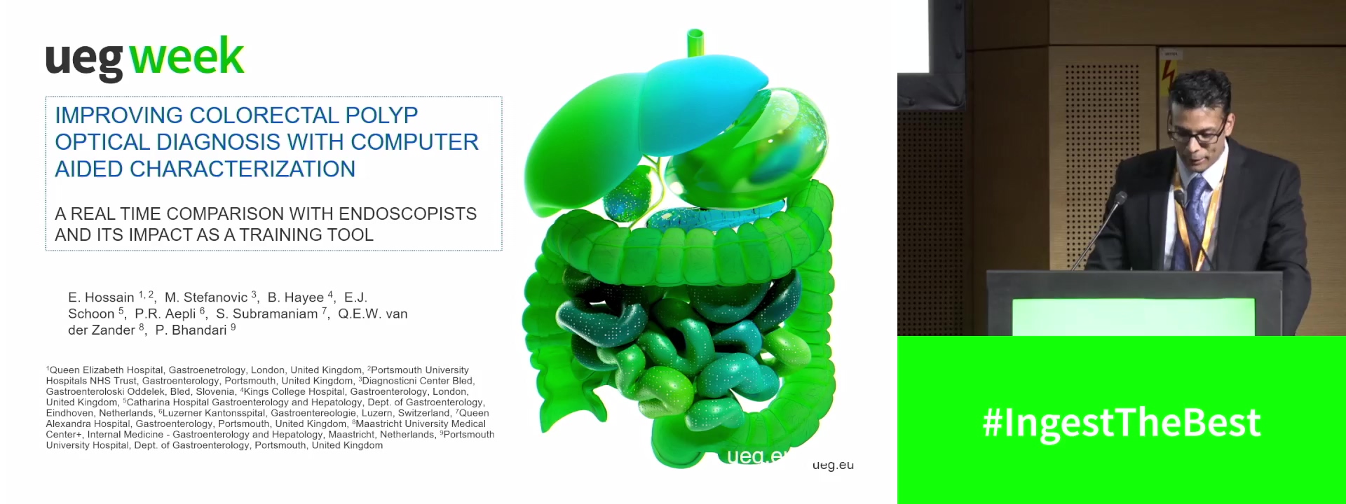 IMPROVING COLORECTAL POLYP OPTICAL DIAGNOSIS WITH COMPUTER AIDED CHARACTERIZATION: A REAL TIME COMPARISON WITH ENDOSCOPISTS AND ITS IMPACT AS A TRAINING TOOL