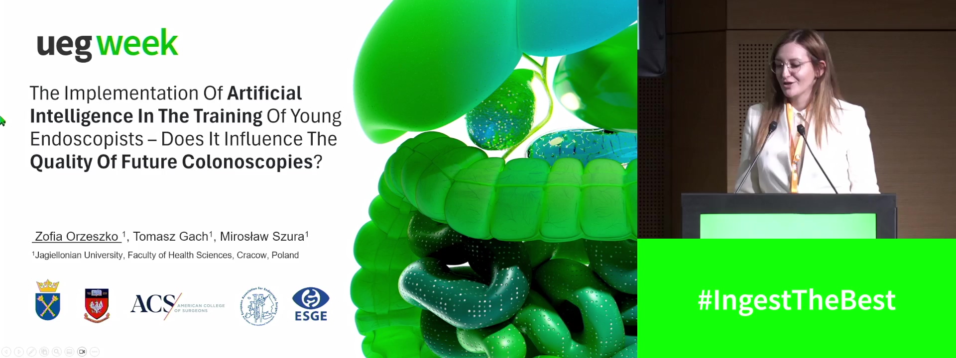 THE ARTIFICIAL INTELLIGENCE IMPLEMENTATION IN THE TRAINING OF YOUNG ENDOSCOPISTS - DOES IT INFLUENCE THE QUALITY OF FUTURE COLONOSCOPIES?