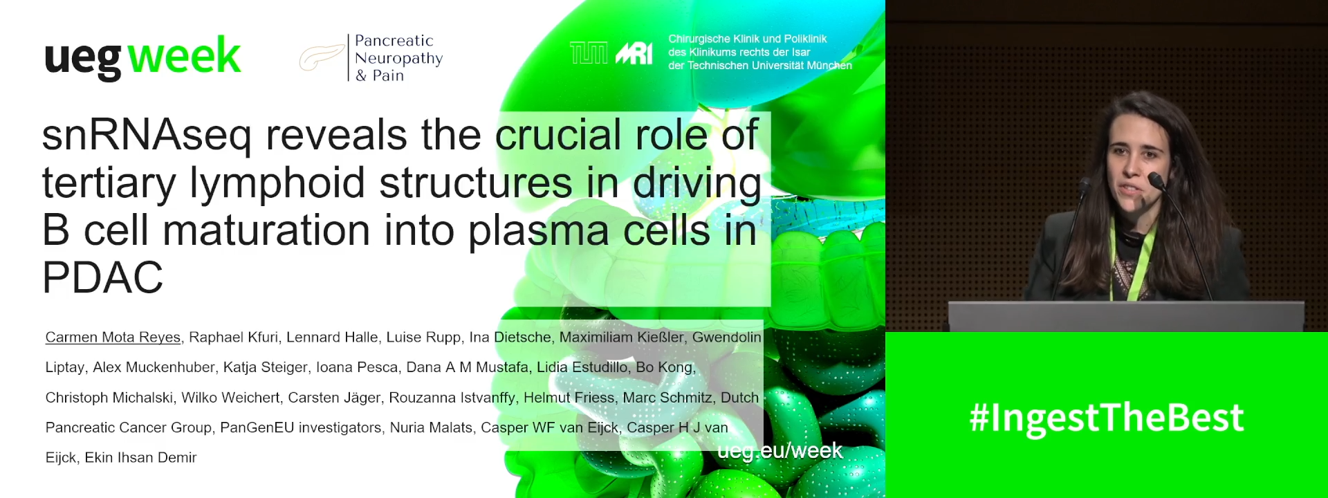 SINGLE-NUCLEUS RNA SEQUENCING REVEALS THE CRUCIAL ROLE OF TERTIARY LYMPHOID STRUCTURES IN DRIVING B CELL MATURATION INTO PLASMA CELLS IN PDAC