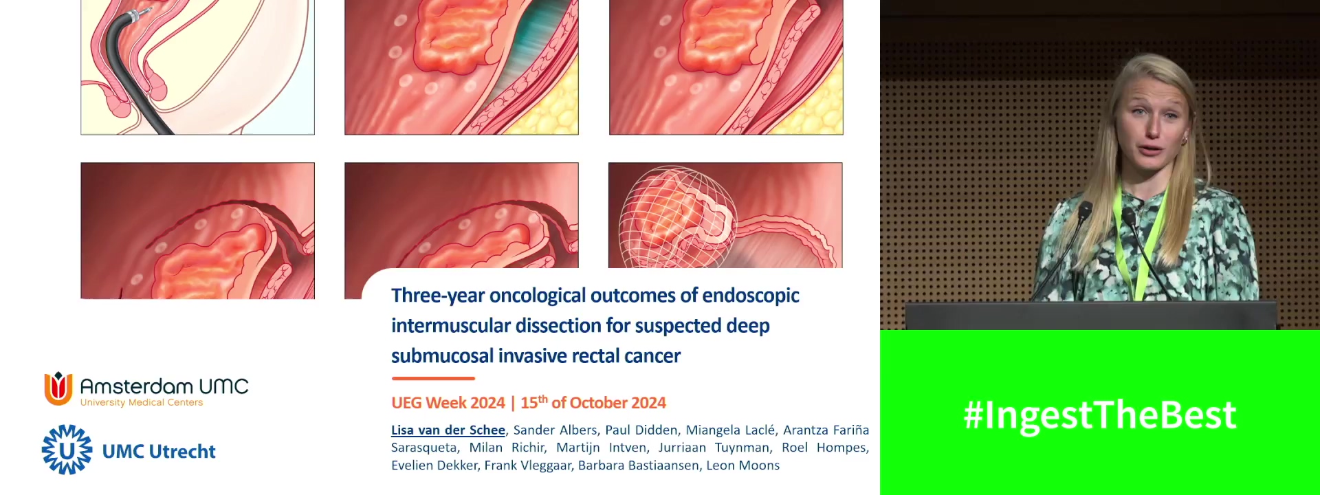 THREE-YEAR ONCOLOGICAL OUTCOMES OF ENDOSCOPIC INTERMUSCULAR DISSECTION FOR SUSPECTED DEEP SUBMUCOSAL INVASIVE RECTAL CANCER