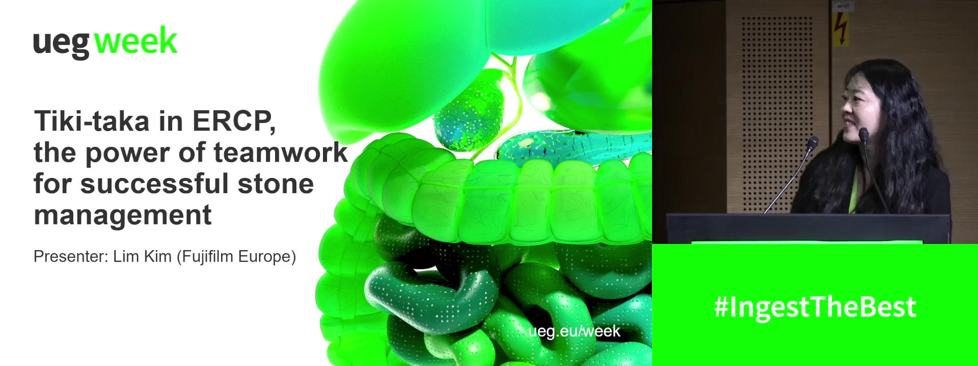 Tiki-taka in ERCP: The power of teamwork for successful stone management