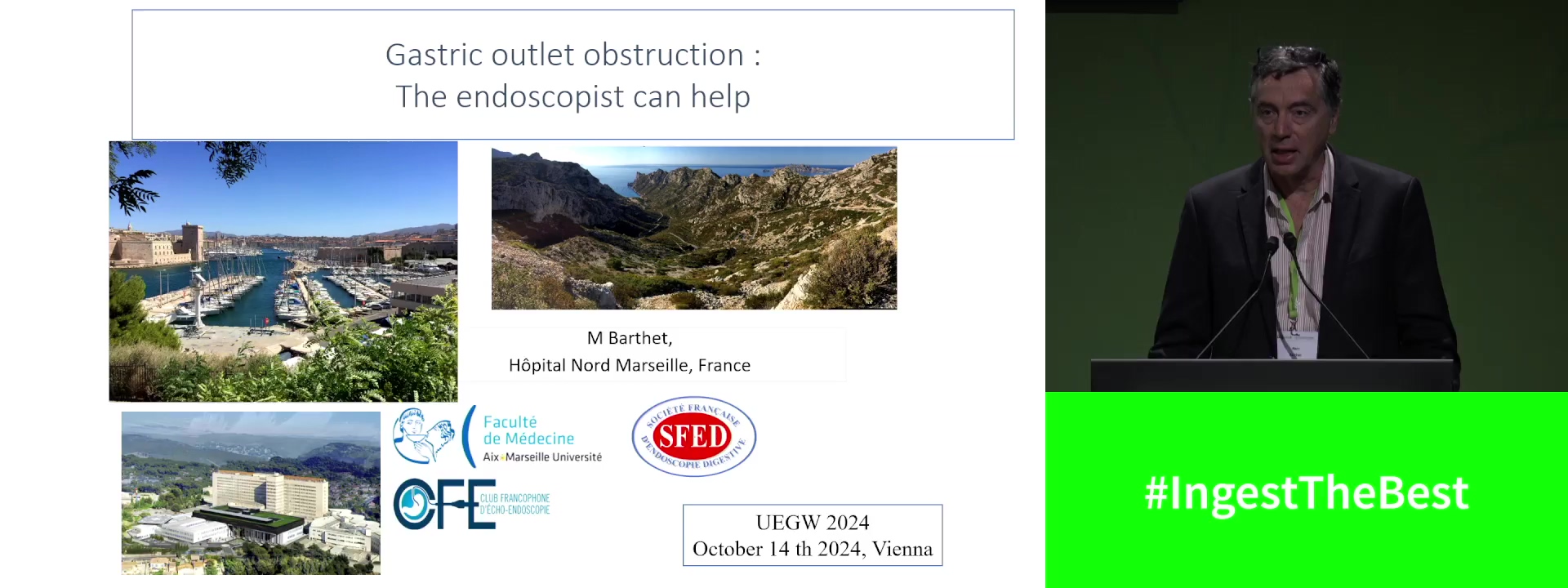 Gastric outlet obstruction: Who can help? Endoscopist or surgeon
