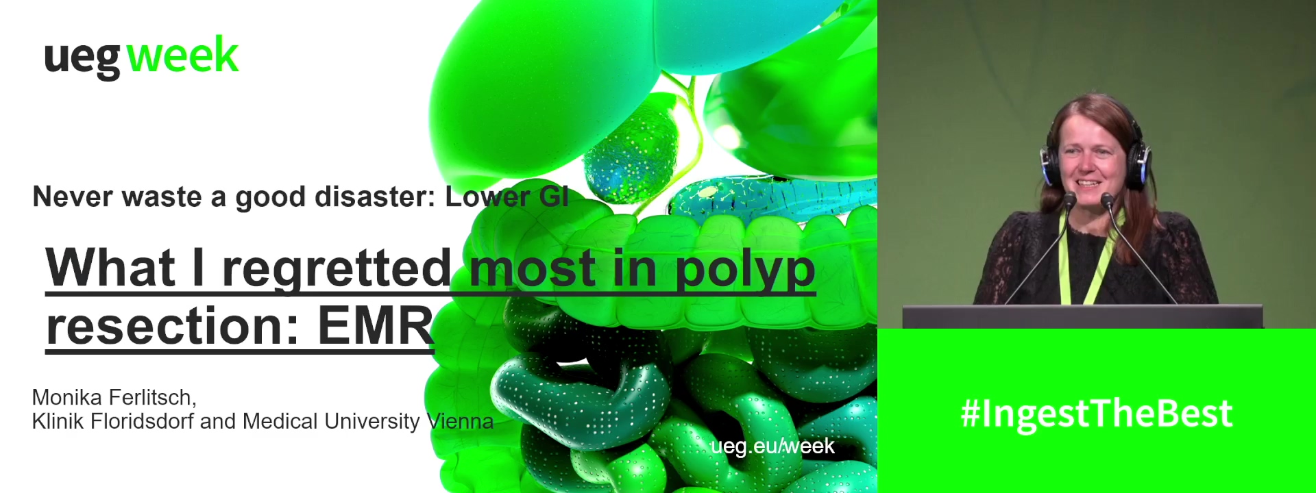 What I regretted most in polyp resection: EMR and ESD
