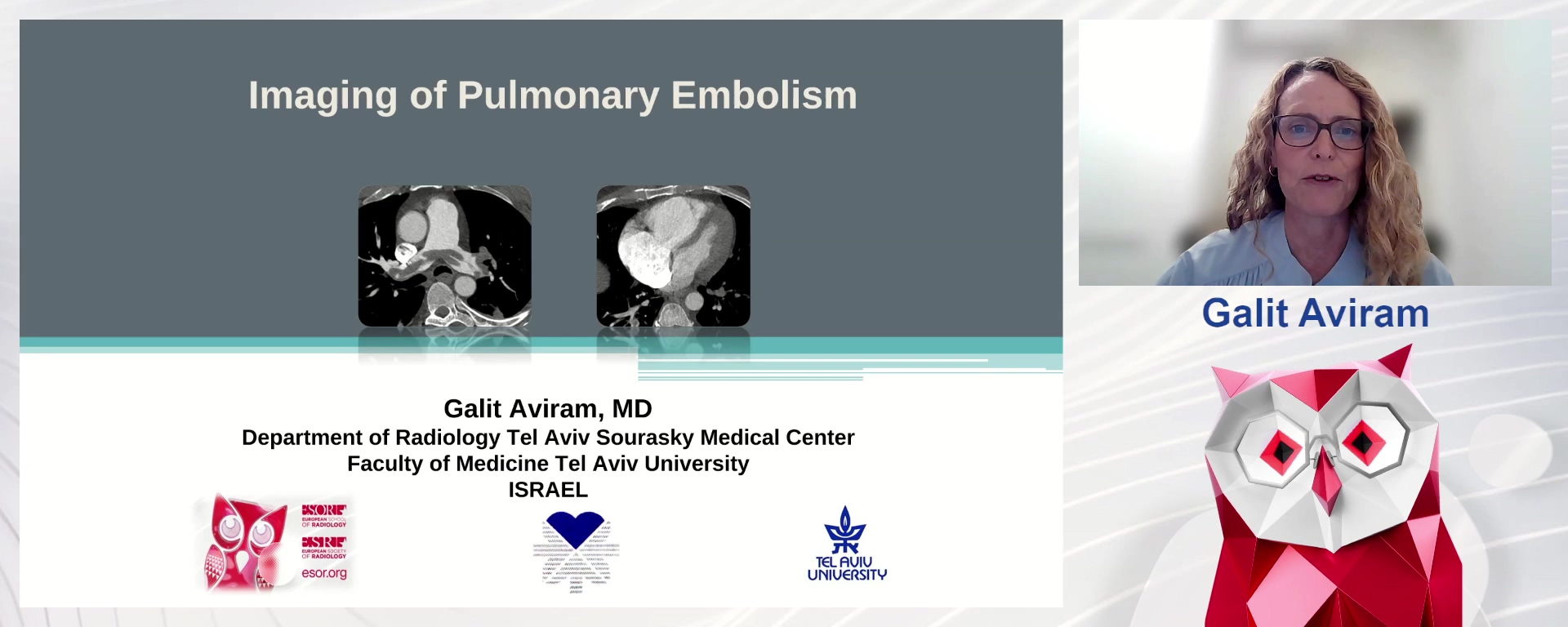 Imaging of Pulmonary Embolism