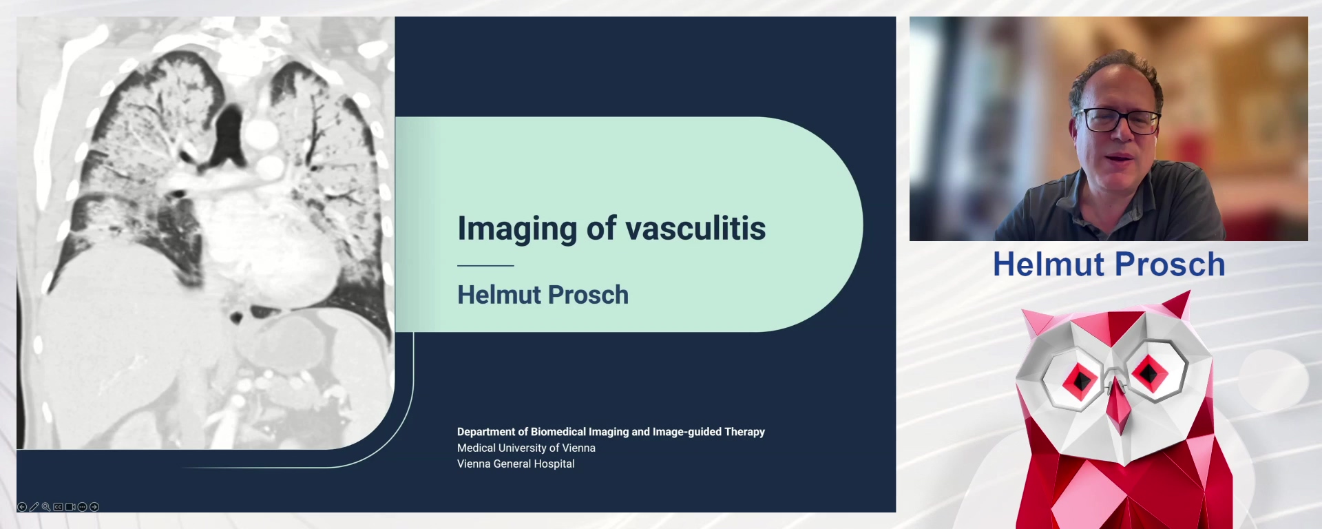 Vasculitis – What Radiologists Need to Know