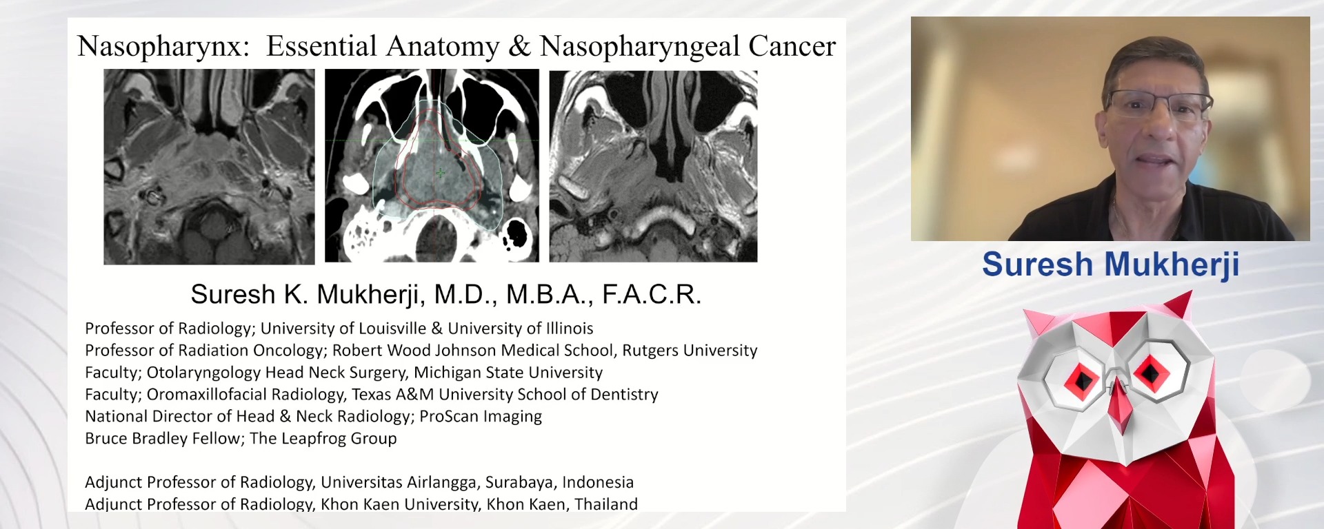 Nasopharynx: essential anatomy and nasopharyngeal cancer