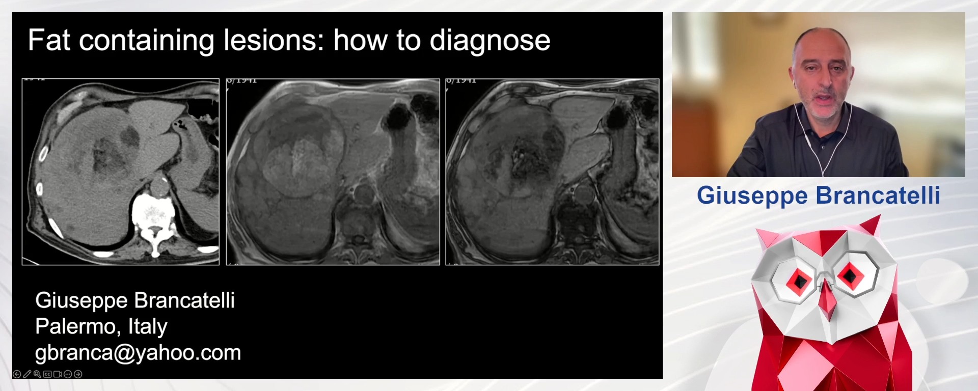 Fat containing hepatic lesions: how to diagnose