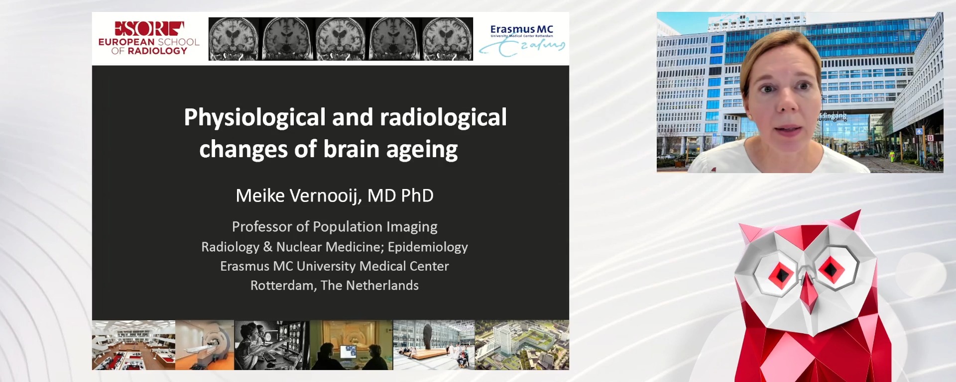Physiological and radiological changes of brain ageing