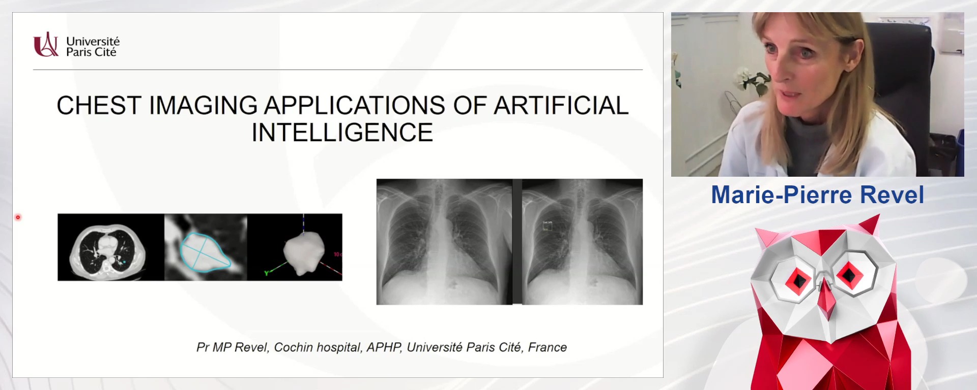 Chest imaging applications of artificial intelligence