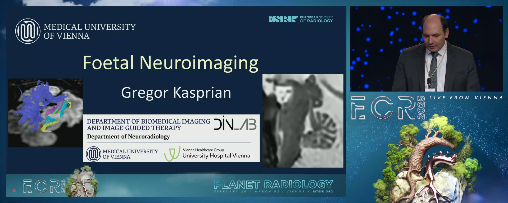 Foetal neuroimaging